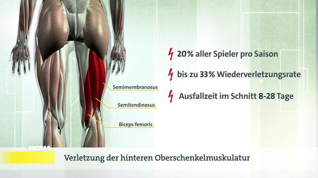 Sportschlau: Oberschenkelverletzungen bei Profifußballern